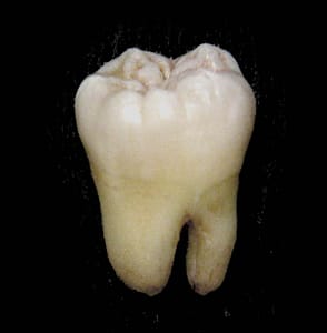 Image used under a Collective Commons License from https://en.wikipedia.org/wiki/Molar_(tooth)